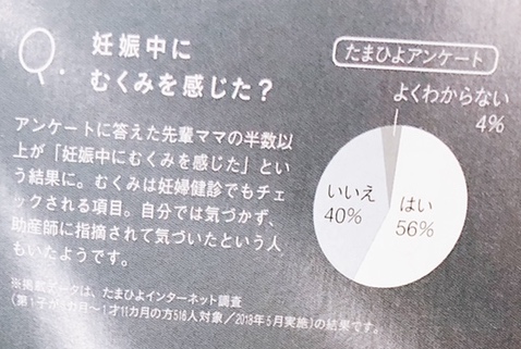 妊娠中56%がむくみで悩む